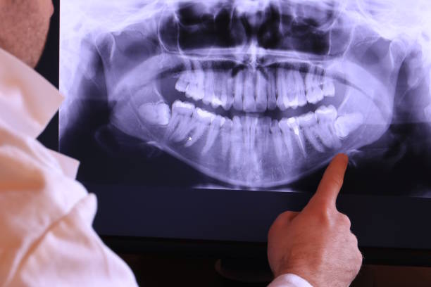 Best Broken Tooth Emergency  in Highland Park, NJ